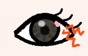 治らないものもらいの効果的な対処法を解説する記事のイメージ画像