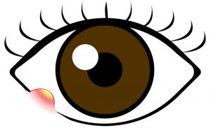 ものもらいによる瞼の腫れの治療法を解説する記事のイメージ画像