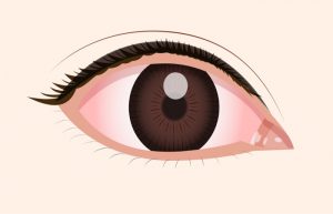 ドライアイの原因と予防方法を3分で解説する記事のアイキャッチ画像