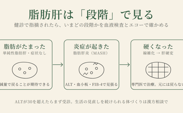 脂肪肝は段階で見る。脂肪がたまっただけの段階は減量で戻ることが期待でき、炎症が起きた脂肪肝炎はALT・血小板・FIB-4で見張り、線維化して肝硬変になると元に戻らない
